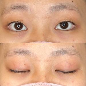 藤・ナチュレ美容クリニック 藤・ナチュレ美容クリニック 恵比寿院口コミ