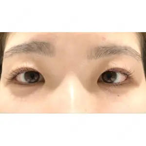 湘南美容クリニック 湘南美容クリニック 池袋東口院口コミ