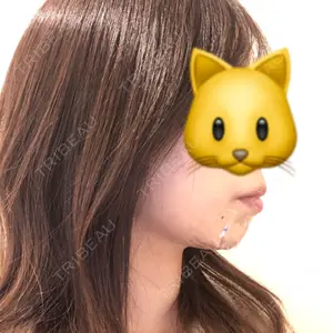 TCB東京中央美容外科 TCB東京中央美容外科 新宿三丁目院口コミ