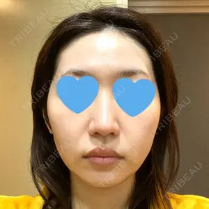 口コミ