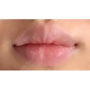 B-LINE CLINIC B-LINE CLINIC 池袋院口コミ