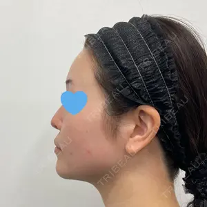 湘南美容クリニック 湘南美容クリニック 秋葉原院口コミ