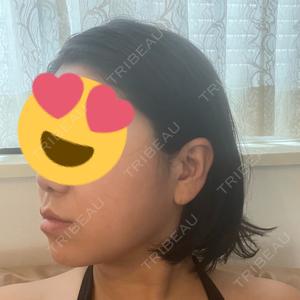 TCB東京中央美容外科 TCB東京中央美容外科 広島院口コミ