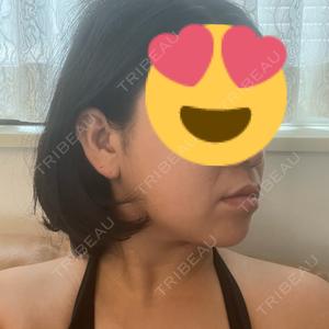 TCB東京中央美容外科 TCB東京中央美容外科 広島院口コミ