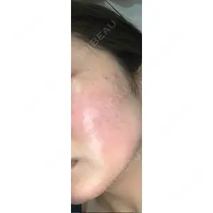 APOLLO BEAUTY CLINIC口コミ