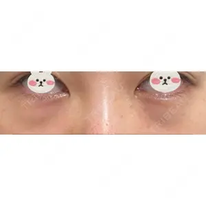 APOLLO BEAUTY CLINIC口コミ
