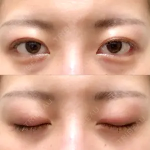 ルネッサンス美容外科医院 ルネッサンス美容外科医院 青山本院口コミ