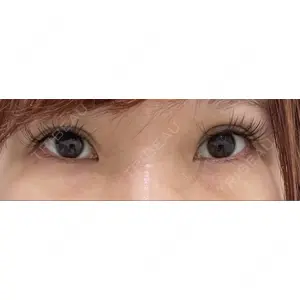 HAAB×DREAM BEAUTY CLINIC HAAB×DREAM BEAUTY CLINIC 東京本院口コミ