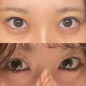 湘南美容クリニック 湘南美容クリニック 新宿南口院口コミ