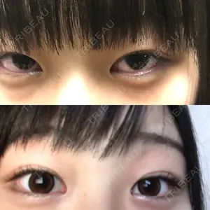 品川美容外科 品川美容外科 静岡院口コミ