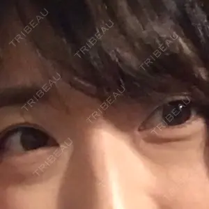 APOLLO BEAUTY CLINIC口コミ