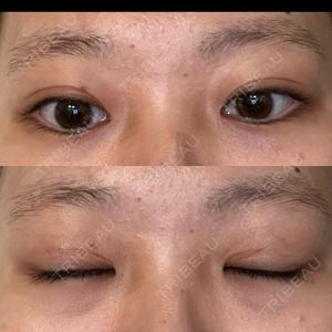 藤・ナチュレ美容クリニック 藤・ナチュレ美容クリニック 恵比寿院口コミ