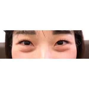セオリークリニック口コミ