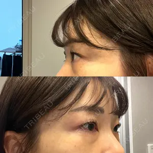 セオリークリニック口コミ