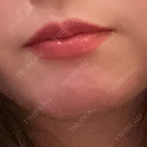 東京シンデレラ美容外科 東京シンデレラ美容外科 池袋院口コミ