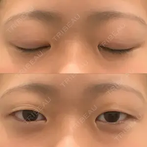 アリエル美容クリニック アリエル美容クリニック 郡山院口コミ
