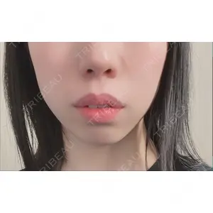 口コミ