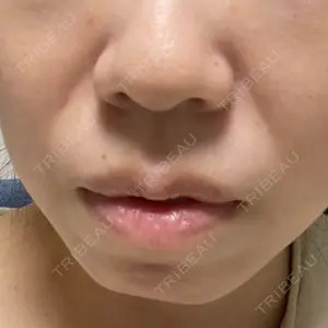 東京シンデレラ美容外科 東京シンデレラ美容外科 池袋院口コミ
