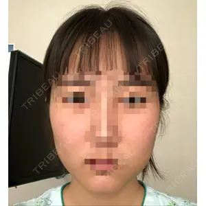 id美容外科の口コミ
