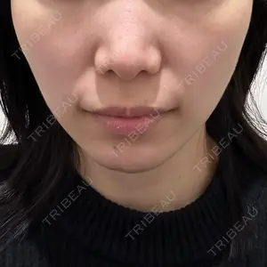 湘南美容クリニック 湘南美容クリニック 新宿本院口コミ