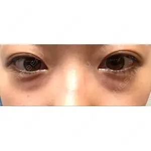 APOLLO BEAUTY CLINIC口コミ