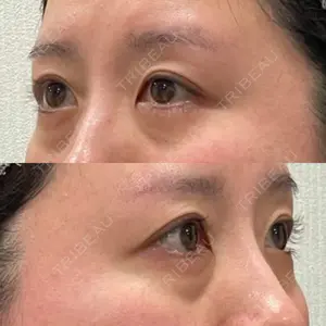 お茶の水美容形成クリニック 吉井クリニック口コミ