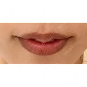 BELINDA CLINIC BELINDA CLINIC（ベリンダクリニック）新宿院口コミ