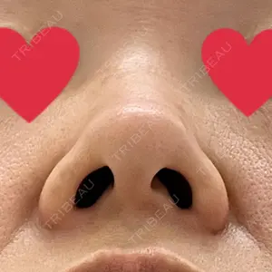 口コミ