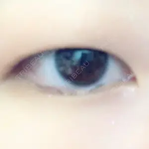 湘南美容クリニック 湘南美容クリニック 東京蒲田院口コミ