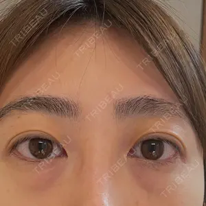 セオリークリニック口コミ