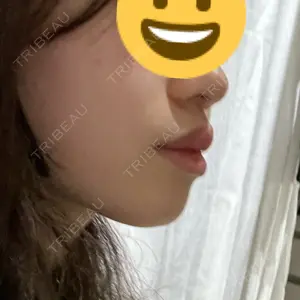 口コミ