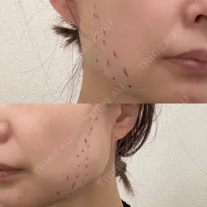 共立美容外科・歯科 共立美容外科 梅田院口コミ