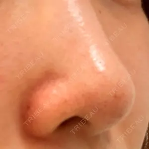 Zetith Beauty Clinic Zetith Beauty Clinic 銀座院口コミ