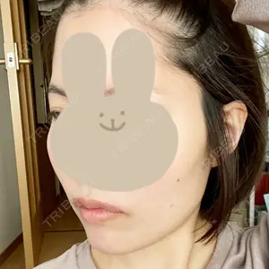 口コミ