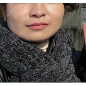 口コミ