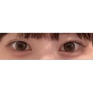 湘南美容クリニック 湘南美容クリニック 表参道院口コミ