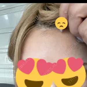 TCB東京中央美容外科 TCB東京中央美容外科 千葉駅前院口コミ