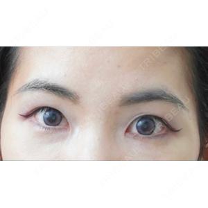 BIANCA CLINIC BIANCA表参道口コミ