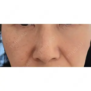 アスク美容クリニック銀座口コミ