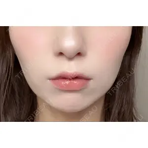 フィラークリニック フィラークリニック 町田院口コミ