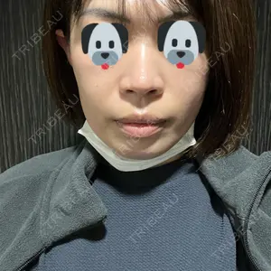 X CLINIC X CLINIC 銀座院口コミ