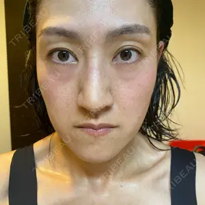 プラチナクリニック口コミ