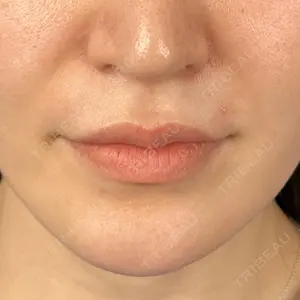 藤・ナチュレ美容クリニック 藤・ナチュレ美容クリニック 恵比寿院口コミ