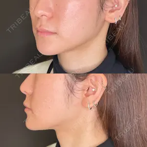 藤・ナチュレ美容クリニック 藤・ナチュレ美容クリニック 恵比寿院口コミ