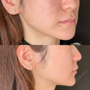 藤・ナチュレ美容クリニック 藤・ナチュレ美容クリニック 恵比寿院口コミ