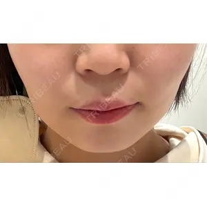 AI Beauty Clinic （エーアイ美容クリニック）口コミ