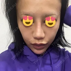 東京形成美容外科 東京形成美容外科 船橋院口コミ
