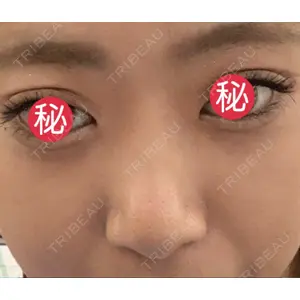 トアロード形成美容クリニック口コミ