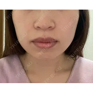 TCB東京中央美容外科 TCB東京中央美容外科 高田馬場院口コミ