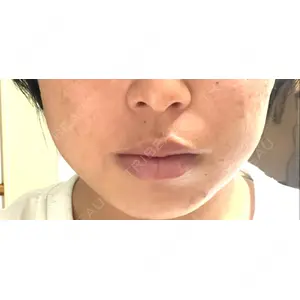 TCB東京中央美容外科 TCB東京中央美容外科 浜松院口コミ